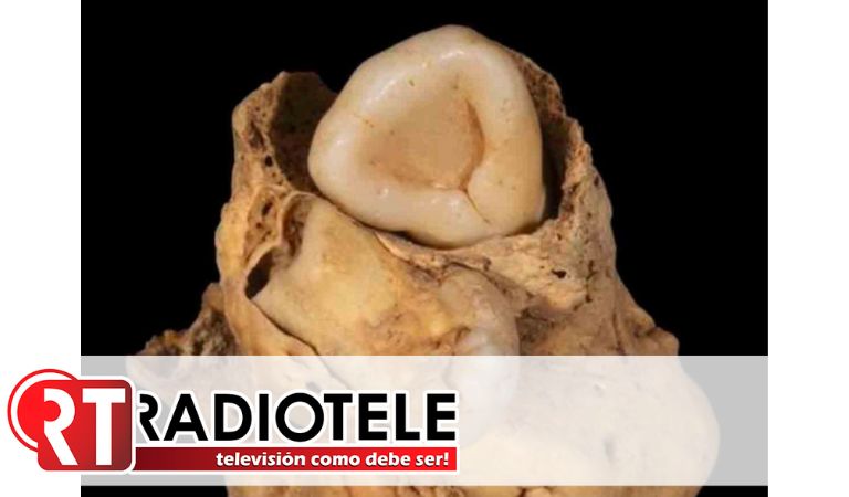 Expertos hallan un tumor con dientes en la pelvis de una antigua egipcia